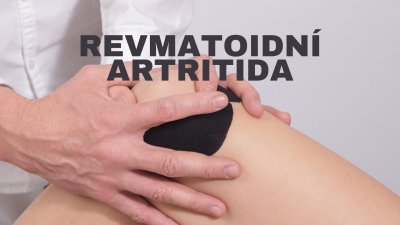 Revmatoidní artritida: Příznaky, léčba, a jaká je prevence? | ARNO.cz - obuv s tradicí
